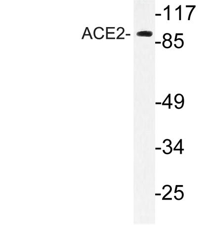 ACE2 rabbit pAb 50µL/100µL