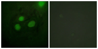RPA32 rabbit pAb 50µL/100µL