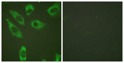 Ribosomal Protein S6 (phospho Ser240) rabbit pAb 50µL/100µL
