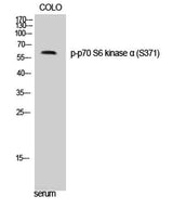 p70 S6 kinase α (phospho Ser371) rabbit pAb