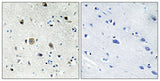Ribosomal Protein S20 rabbit pAb 50µL/100µL