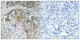ENaC β (phospho Thr615) rabbit pAb