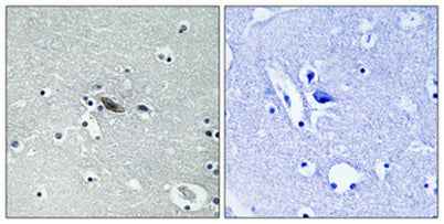 Syntaxin 1 (phospho Ser14) rabbit pAb