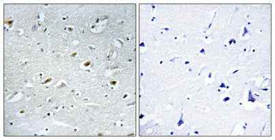 TACC1 rabbit pAb