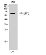 TH (phospho Ser62) rabbit pAb