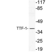 TTF-1 rabbit pAb