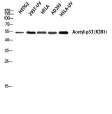 p53 (Acetyl Lys381) rabbit pAb