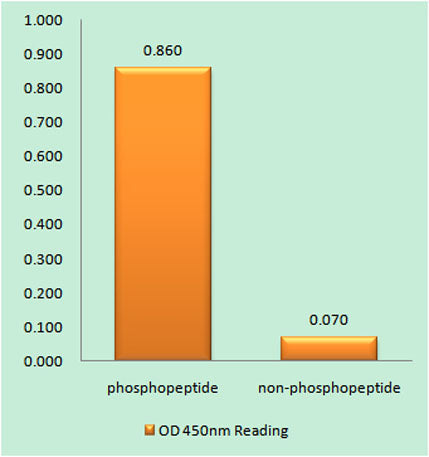 VDR (phospho Ser208) rabbit pAb 50µL/100µL
