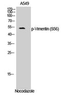 Vimentin (phospho Ser56) rabbit pAb