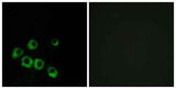 VPAC1 rabbit pAb