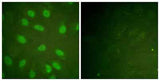 Ku-80 (phospho Thr714) rabbit pAb