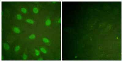 Ku-80 (phospho Thr714) rabbit pAb