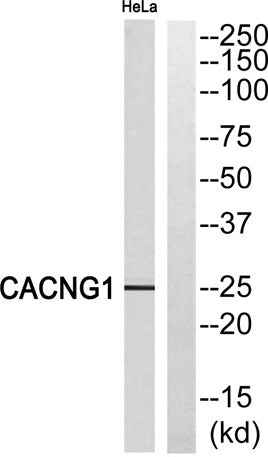 L-type Ca++ CP γ1 rabbit pAb