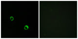 CARD 14 rabbit pAb 50µL/100µL