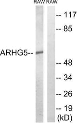 Oncogene TIM rabbit pAb