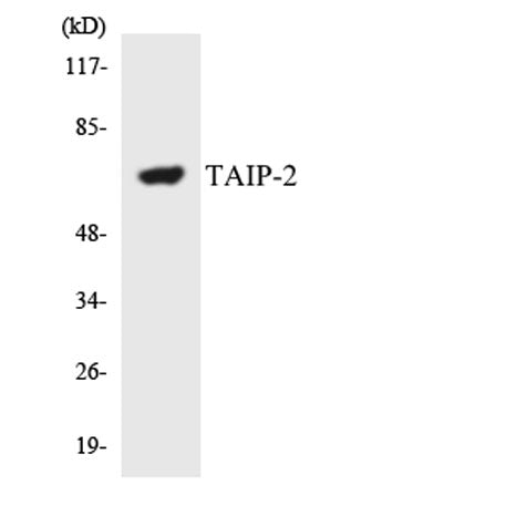 CSRNP3 rabbit pAb 50µL/100µL