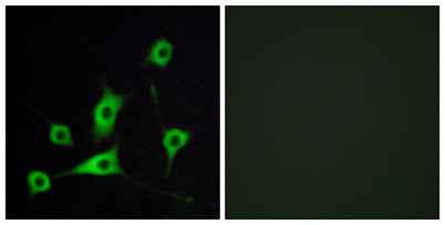 CRBP-III rabbit pAb