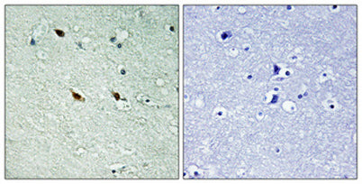 NIFK (phospho Thr234) rabbit pAb 50µL/100µL