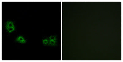 TMEM185A rabbit pAb 50µL/100µL