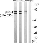 p63 (phospho Ser395) rabbit pAb
