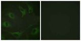 Cbl (phospho Tyr774) rabbit pAb