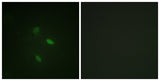 Cyclin E2 rabbit pAb 50µL/100µL