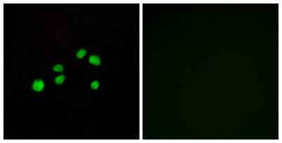 COL23A1 rabbit pAb