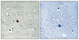 Nek9 (phospho Thr210) rabbit pAb 50µL/100µL