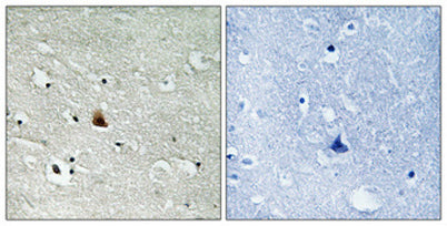 Nek9 (phospho Thr210) rabbit pAb 50µL/100µL