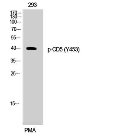 CD5 (phospho Tyr453) rabbit pAb
