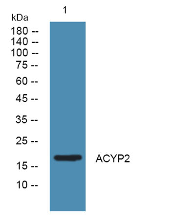 ACYP2 rabbit pAb 50µL/100µL