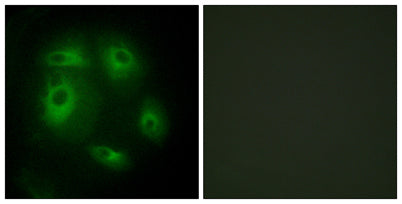 DLEC1 rabbit pAb 50µL/100µL