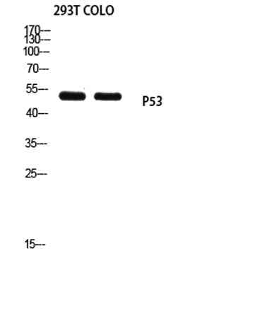 p53 (Mono Methyl Lys370) rabbit pAb