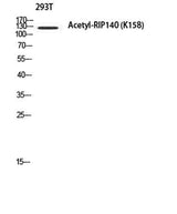 RIP140 (Acetyl Lys158) rabbit pAb