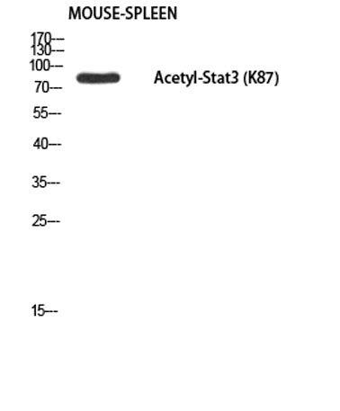 Stat3 (Acetyl Lys87) rabbit pAb 50µL/100µL