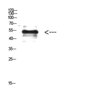 Vimentin (Phospho-Tyr38) rabbit pAb