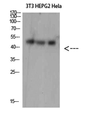 SPOP rabbit pAb 50µL/100µL