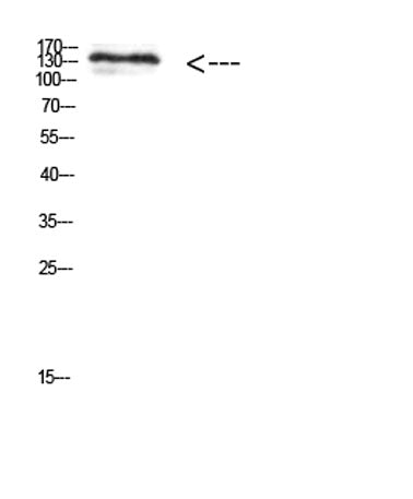 MIB1 rabbit pAb 50µL/100µL