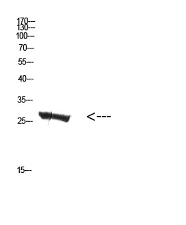 MBL-C rabbit pAb 50µL/100µL