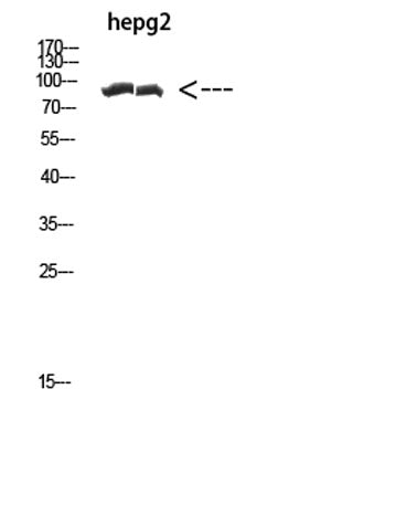 CACTIN rabbit pAb 50µL/100µL