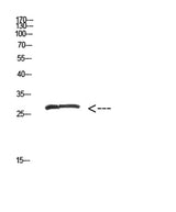 MYOZ2 rabbit pAb 50µL/100µL