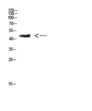 CHID1 rabbit pAb 50µL/100µL