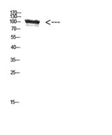 TRPV4 rabbit pAb 50µL/100µL