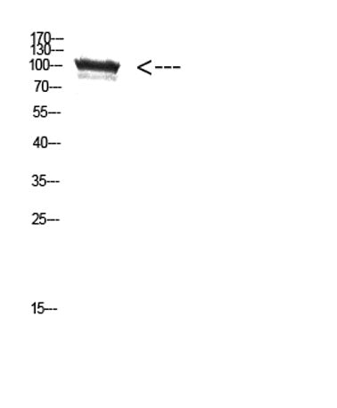 TRPV4 rabbit pAb 50µL/100µL