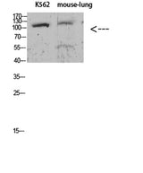 Sodium Potassium ATPase alpha-1 (Phospho-Tyr260) Rabbit pAb 50µL/100µL