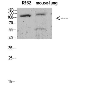 Sodium Potassium ATPase alpha-1 (Phospho-Tyr260) Rabbit pAb 50µL/100µL