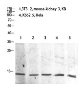Histone H2B (Acetyl Lys21) rabbit pAb 50µL/100µL