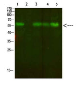 AVP Receptor V2 rabbit pAb