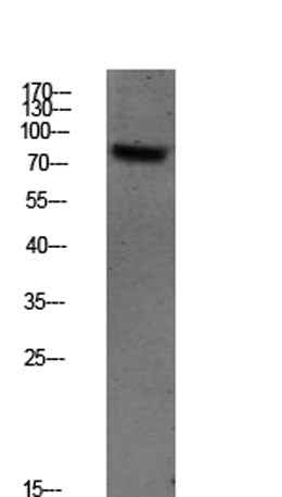 SYK (Phospho-Tyr348) Rabbit pAb