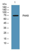 PAK6 rabbit pAb